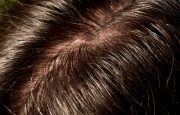 Menopause Greasy Hair